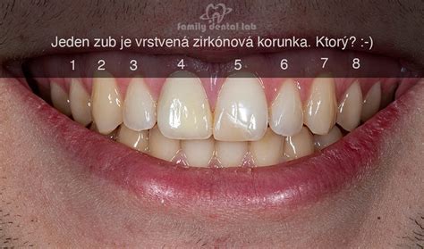 Rozdiel medzi okrasnou paprikou a ľuľkom paprikovitým
