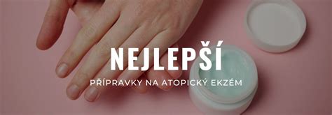 Ilustrácia prírodných prostriedkov na ekzém