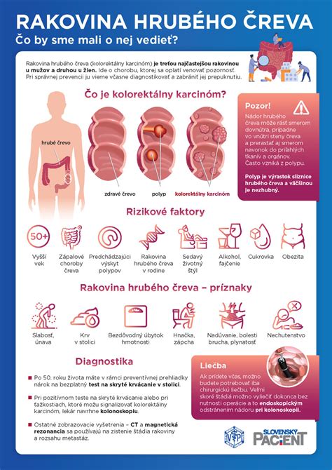 Mapa tela s vyznačenými orgánmi, kam najčastejšie metastázuje rakovina hrubého čreva
