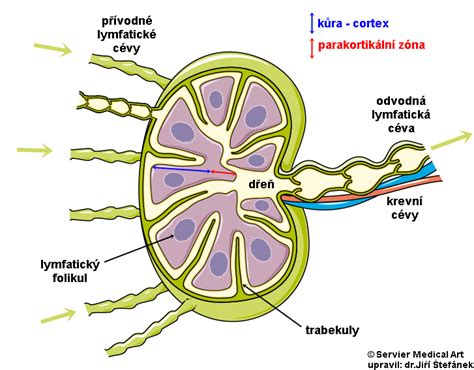Schéma vnútromaternicového telieska v maternici