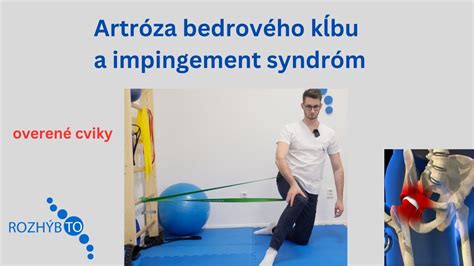 Anatomická schéma bedrového kĺbu