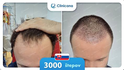 Štruktúra vlasu po regeneračnej kúre
