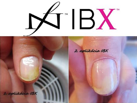 Fázy aplikácie IBX kúry na nechty