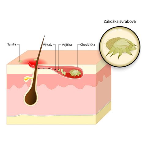 Schéma možných zdravotných problémov u morčiat