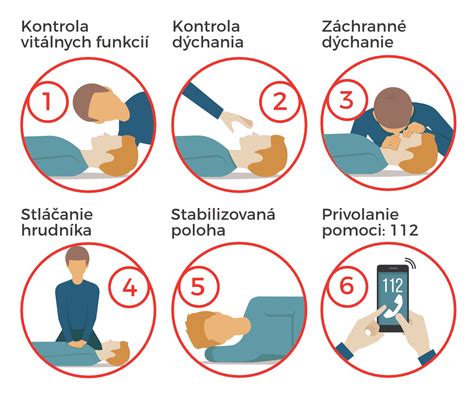 Ilustrácia zobrazujúca správny postup prvej pomoci pri dusení sa jedlom.