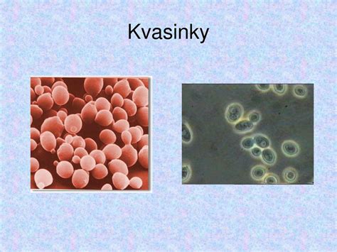 Ilustrácia mikroskopického pohľadu na baktérie a kvasinky v kvásku