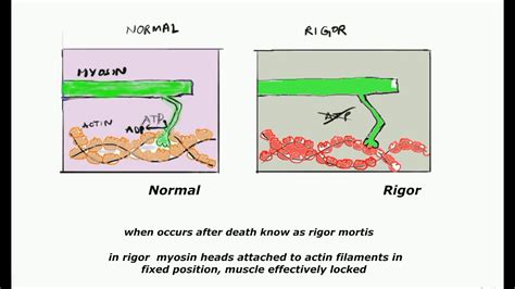Schéma rigor mortis