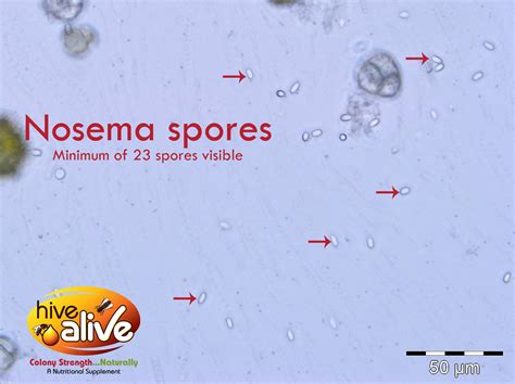 Mikroskopické zobrazenie spór Nosema