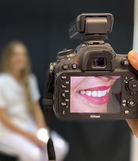 Fotografia roľníckych gúľancov