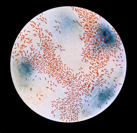 Ilustrácia baktérie Haemophilus influenzae