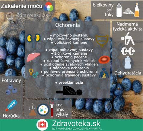 infografika zobrazujúca hlavné príčiny obezity