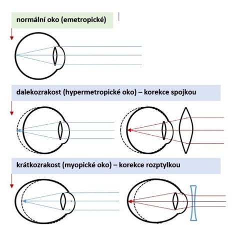 optické rozšírenie očí linkou