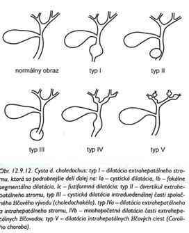 Anatomické znázornenie žlčníka a žlčových ciest