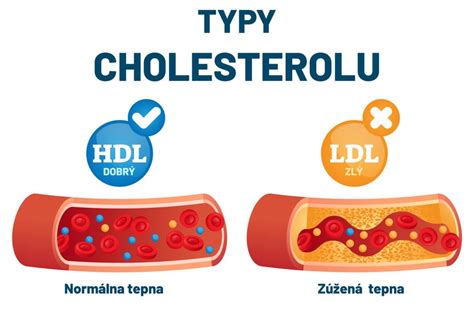 Infografika o obsahu cholesterolu vo vajciach a jeho vplyve na zdravie