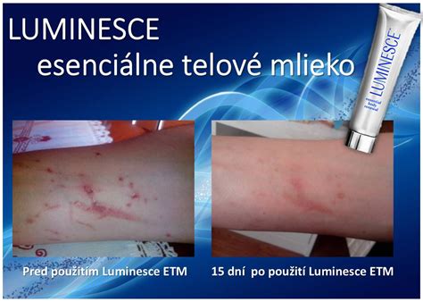 Porovnanie pokožky pred a po použití telového mlieka s efektom opálenia