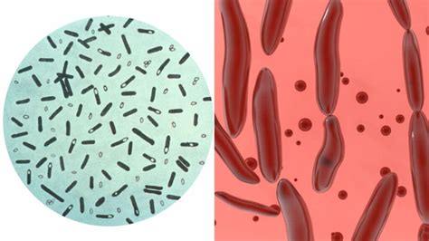 Ilustrácia spór baktérie Clostridium botulinum