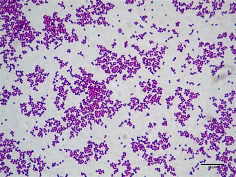 Bakteriálne zhluky Staphylococcus aureus pod mikroskopom