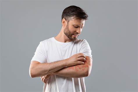 Príklad kožnej infekcie spôsobenej stafylokokom - vred