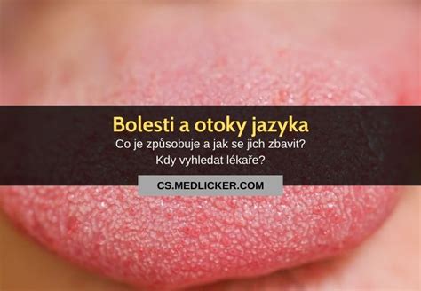 Štruktúra jazyka s papilami