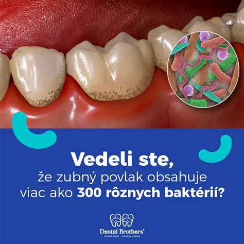 Infografika o tvorbe zubného kameňa