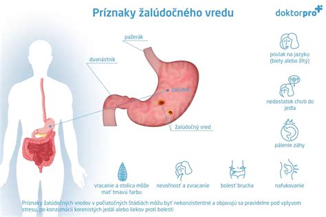 Schéma žalúdočného vredu