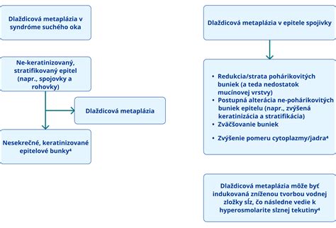 Diagram zobrazujúci vzťah medzi hlavným dokumentom a jeho prílohami (annexes)