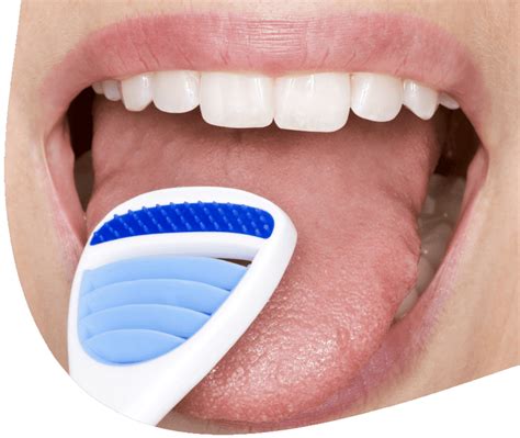 Ilustrácia jazyka s bielym povlakom a čistého jazyka