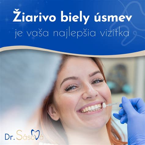 Infografika o správnej starostlivosti o zuby po bielení