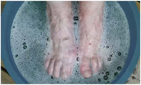 Infografika zobrazujúca zloženie a účinky rôznych kúpeľov na nohy