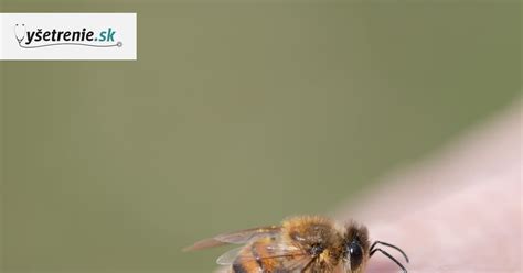 Bodnutie včelou a osou