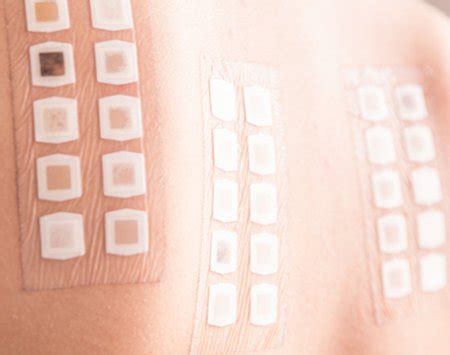 Alergologické testy