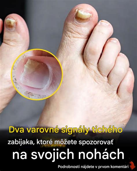 Kedy navštíviť lekára pri hnačke