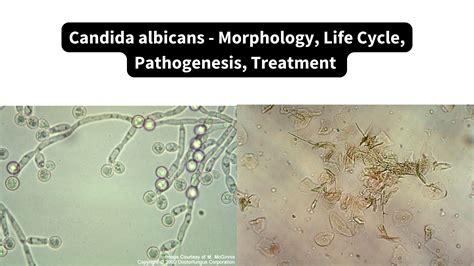 Mikroskopický snímok Candida albicans