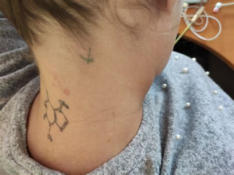 Ilustrácia tvarohového obkladu na krku