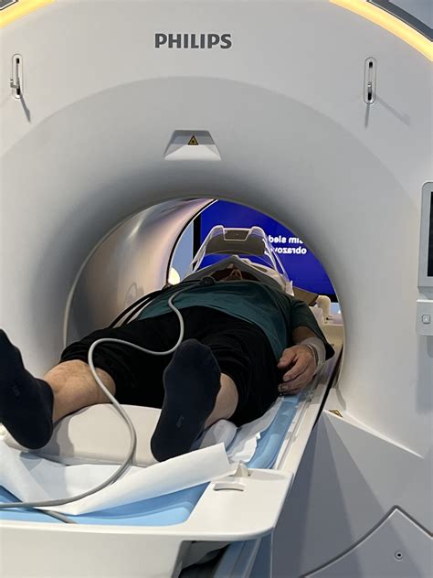 Magnetická rezonancia (MR) zobrazujúca hepatocelulárny adenóm