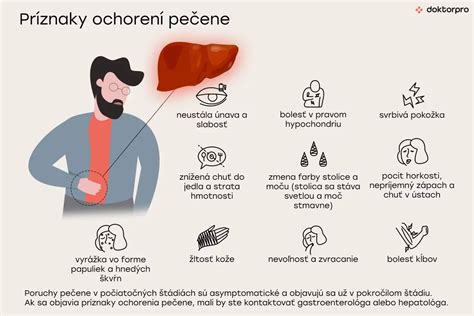 Infografika zobrazujúca hlavné príznaky ochorení pečene