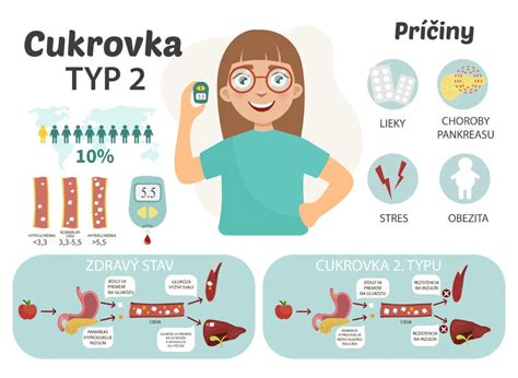 Infografika zobrazujúca rôzne typy kuchýň