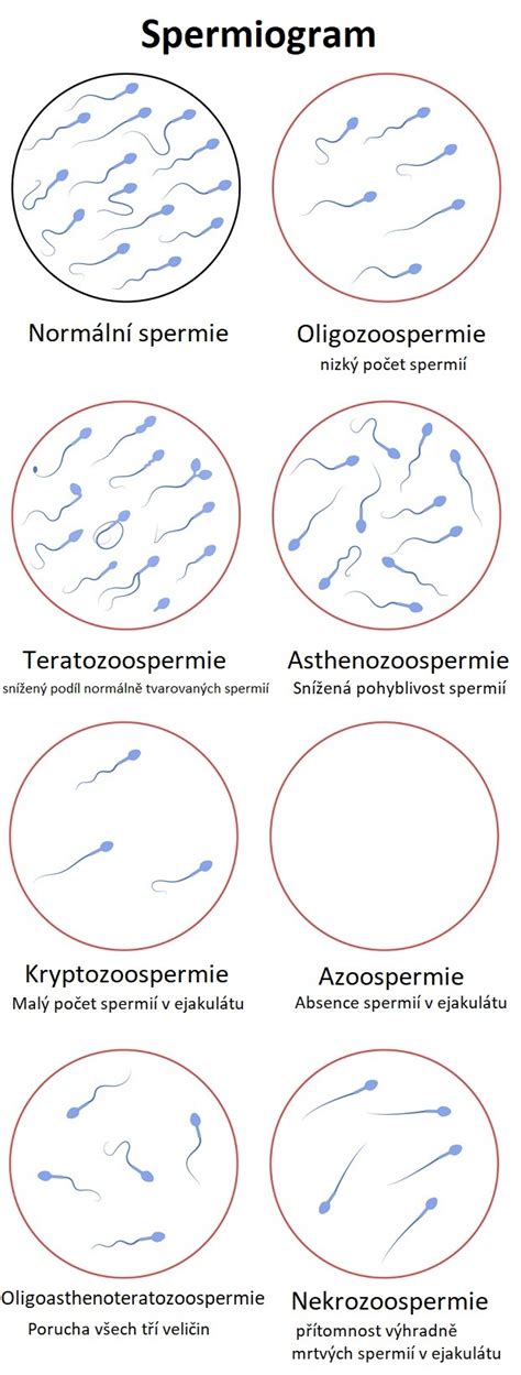 Spermiogram - analýza kvality spermií