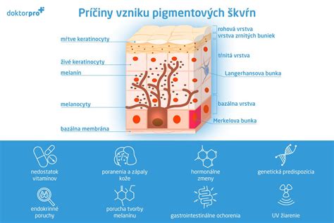 Schéma porovnávajúca prírodné a chemické metódy liečby pigmentových škvŕn
