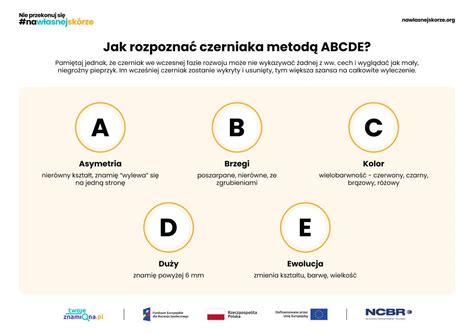 Infografika ABCDE pravidlo pre identifikáciu podozrivých znamienok