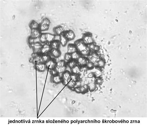 Škrobové granule pod mikroskopom