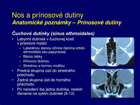 Anatómia prínosových dutín