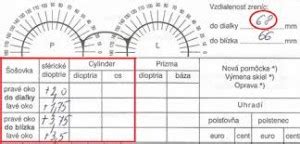 Schematické znázornenie oka s vyznačenými parametrami pre predpis okuliarov