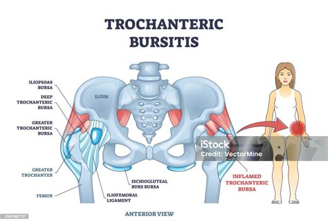 Diagram troch dóš v ajurvéde