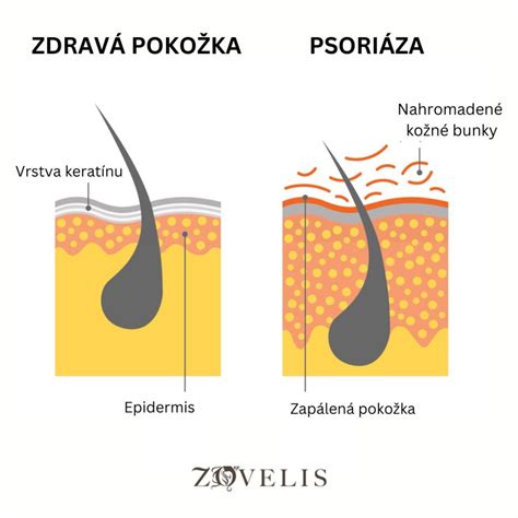 Ilustrácia správneho testovania depilačného krému na pokožke