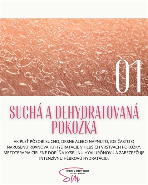 Ilustrácia hydratácie pokožky