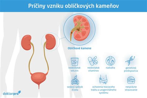 Schéma prevencie obličkových kameňov