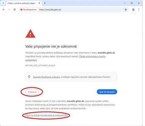 bezpečnostné upozornenie na hračky