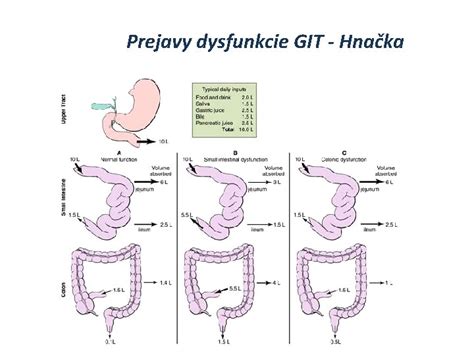 Schéma vredovej choroby žalúdka