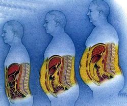 Vizualizácia viscerálneho tuku okolo orgánov